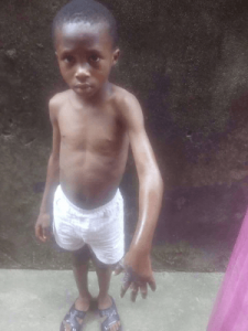 Young Boy Badly Burnt For Stealing N200